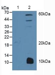 Western Blot; Sample: Lane1: Human MCF7 cells; Lane2: Mouse Liver Tissue.