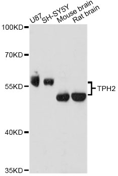 Anti-TPH2 Antibody