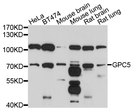 Anti-GPC5 Antibody