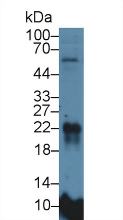 Western Blot; Sample: Rat Lung lysate; Primary Ab: 5µg/ml Rabbit Anti-Rat MFAP5 Antibody Second Ab: 0.2µg/mL HRP-Linked Caprine Anti-Rabbit IgG Polyclonal Antibody