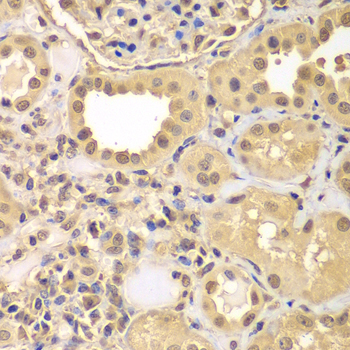 Anti-ARNT2 Antibody