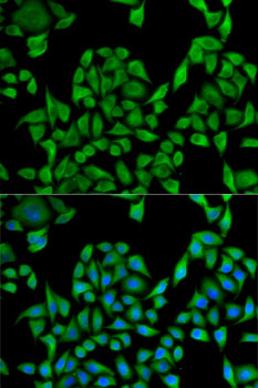 Anti-UGT1A1 Antibody