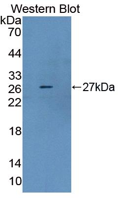 Western Blot; Sample: Recombinant protein.