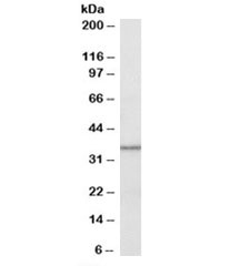 Western blot testing of human liver lysate with HSD11B1 antibody at 0.3ug/ml. Predicted molecular weight: ~32kDa.
