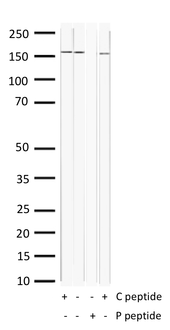Western Blot of 10ug liver lysates from mouse (lanes 1 and 2) and rat (lanes 3 and 4) stained with EGFR-pS1047 Rabbit Polyclonal Antibody AE00306 at 1ug/ml (overnight at 4℃) in the presence (+) or absence (-) of its antigen (P peptide) or its non-phosphorylated control (C peptide). ECL staining by HRP.