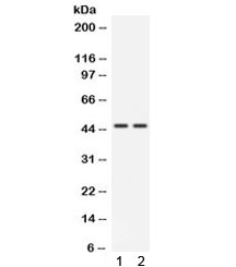 Western blot testing of human 1) HeLa and 2) 22RV1 cell lysate with CTSK antibody. Predicted molecular weight ~37 kDa, with an ~46 kDa pro form and an ~27 kDa mature form.