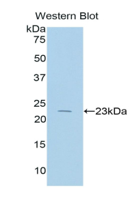 Western Blot; Sample: Recombinant protein.