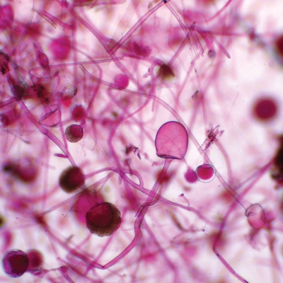 Rhizopus Sporangia, w.m. Microscope Slide