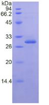 Figure. SDS-PAGE