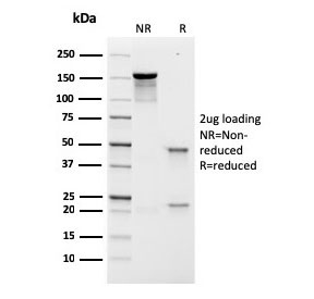 SDS-PAGE analysis of purified, BSA-free recombinant Prolactin Receptor antibody (clone rPRLR/742) as confirmation of integrity and purity.