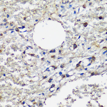 Anti-MRC1 Antibody
