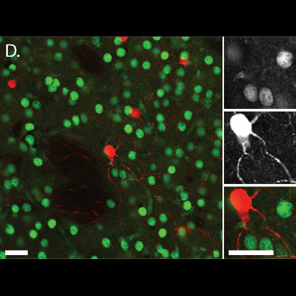 Parvalbumin Antibody