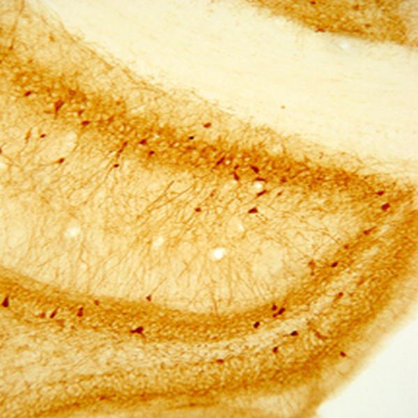 Parvalbumin Antibody