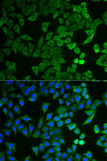 Anti-NPRL2 Antibody