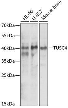 Anti-NPRL2 Antibody