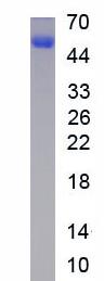 Figure. SDS-PAGE