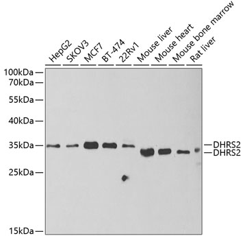 Anti-DHRS2 Antibody