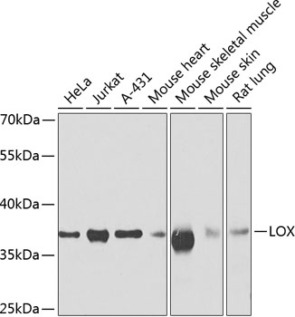 Anti-LOX Antibody