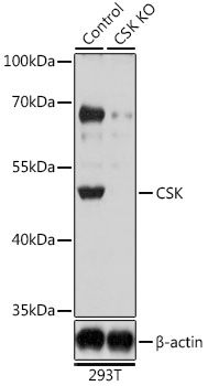 Anti-CSK Antibody