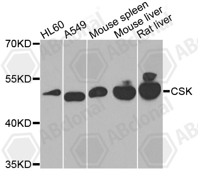 Anti-CSK Antibody
