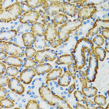 Anti-SLC5A1 Antibody