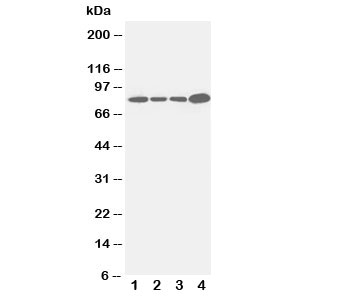 Western blot testing of Integrin beta 3 antibody and Lane 1: Jurkat; 2: Raji; 3: CEM; 4: COLO320 cell lysate