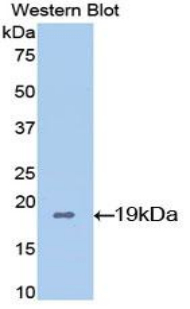 Western Blot; Sample: Recombinant protein.