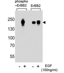 Western blot analysis of extracts from A431 cells, untreated or treated with EGF at 100ng/ml, using phospho-ErBB2 antibody (left) or nonphos-ErBB2 antibody (right).