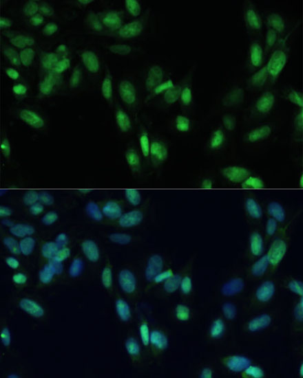 Anti-SMAD7 Antibody