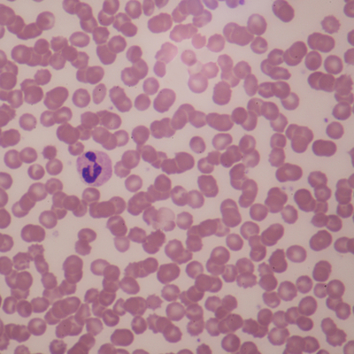 Human Female Blood Film Slide, Smear