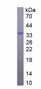 Figure. SDS-PAGE