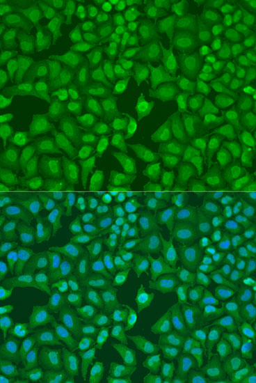 Anti-UHRF1 (di methyl K385) Antibody