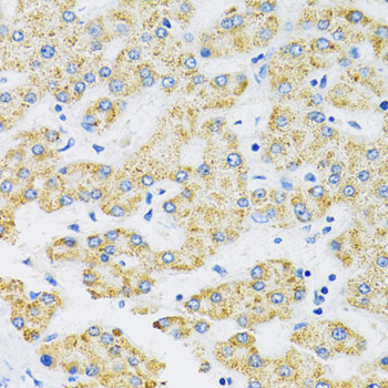 Anti-SLC16A4 Antibody