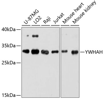 Anti-YWHAH Antibody