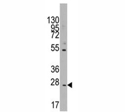 Western blot analysis of CD8B in K562 lysate