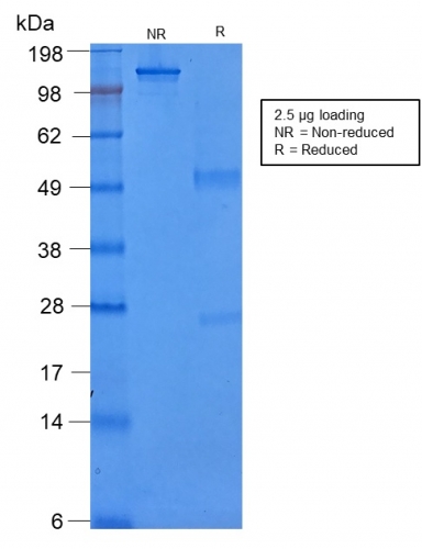 Anti-Cytokeratin 8 Antibody [rB22.1] - BSA and Azide free