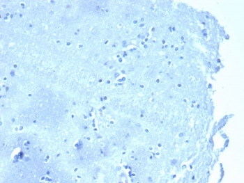 Negative tissue control. IHC analysis of formalin-fixed, paraffin-embedded human brain stained with CTNND1/4383R at 2ug/ml in PBS for 30min RT. HIER: boil tissue sections in pH 9 10mM Tris with 1mM EDTA for 20 min and allow to cool before testing.