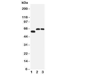 Western blot testing of SLC1A4 antibody and Lane 1: human U87; 2: rat brain; 3: mouse brain tissue lysate. Expected/observed size 60~80KD