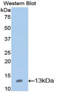 Western Blot; Sample: Recombinant protein.