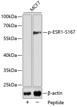 Anti-ESR1 (phospho S167) Antibody