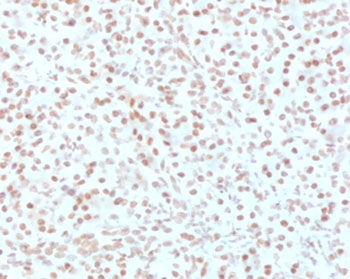 IHC testing of FFPE human pancreas with AKT1 antibody (clone RASTPK-1). HIER: boil tissue sections in pH 9 10mM Tris with 1mM EDTA for 10-20 min followed by cooling at RT for 20 min. 