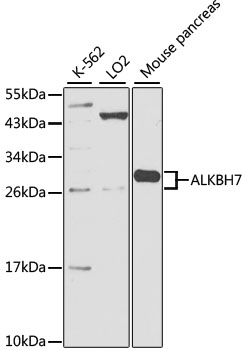Anti-ALKBH7 Antibody