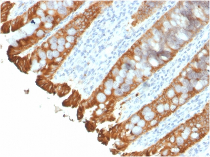 Anti-Cytokeratin 8 + 18 Antibody [KRT8.18/2297R] - BSA and Azide free