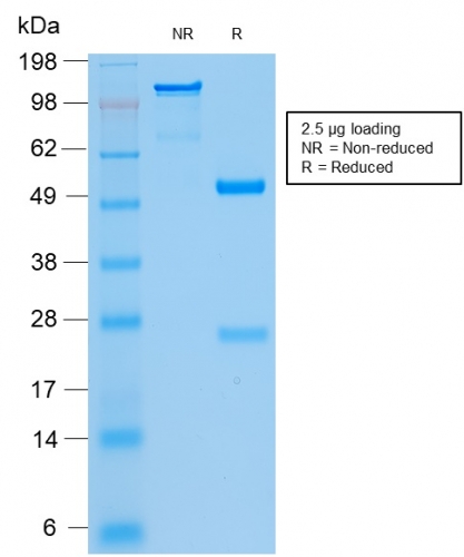 Anti-Cytokeratin 8 + 18 Antibody [KRT8.18/2297R] - BSA and Azide free