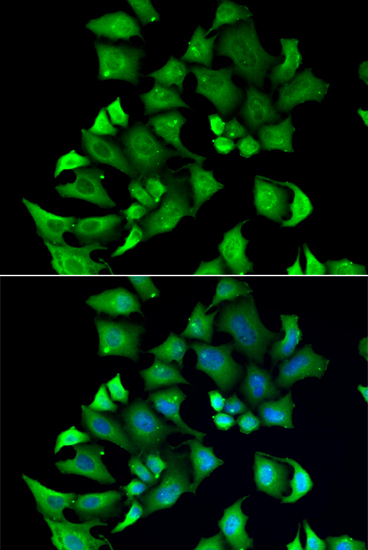 Anti-ENTPD2 Antibody