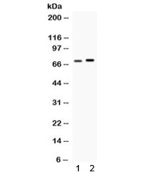 Western blot testing of 1) rat testis and 2) MCF7 lysate with STIP1 antibody. Expected molecular weight: 63/68/60 kDa (isoforms 1/2/3).