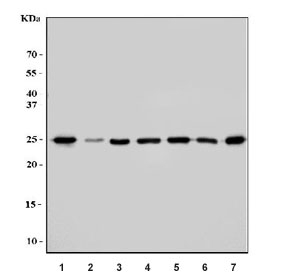 Western blot testing of 1) human HeLa, 2) human 293T, 3) human HepG2, 4) rat liver, 5) rat kidney, 6) mouse liver and 7) mouse kidney tissue lysate with TPI1 antibody. Predicted molecular weight ~26 kDa.