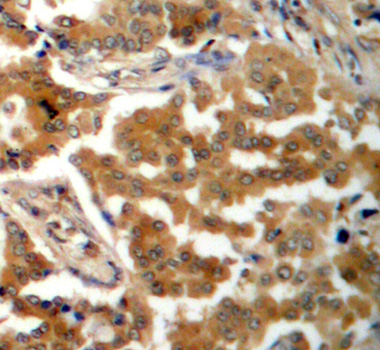 Anti-ADD1 (phospho S726) Antibody