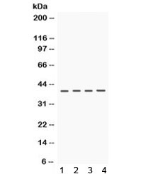 Western blot testing of 1) rat brain, 2) rat kidney, 3) mouse kidney and 4) human HeLa lysate with CSNK1A1 antibody. Expected/observed molecular weight ~39 kDa.