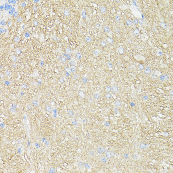 Anti-THY1 Antibody